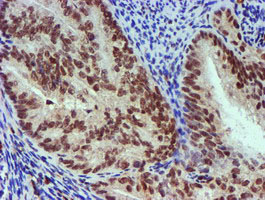 m02676 anti nnmt mouse monoclonal antibody clone id oti3d8 ihc testing 8