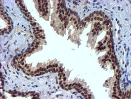m02676 anti nnmt mouse monoclonal antibody clone id oti3d8 ihc testing 9