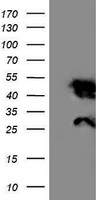 HEK293T cells were transfected with the pCMV6-ENTRY control (Left lane) or pCMV6-ENTRY NNMT (Right lane) cDNA for 48 hrs and lysed