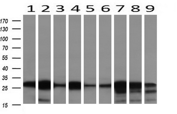 Western blot analysis of extracts (10ug) from 9 Human tissue by using anti-NNMT monoclonal antibody at 1:200 (1: Testis; 2: Omentum; 3: Uterus; 4: Breast; 5: Brain; 6: Liver; 7: Ovary; 8: Thyroid gland; 9: colon)