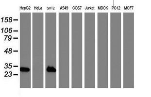 Western blot analysis of extracts (35ug) from 9 different cell lines by using anti-NNMT monoclonal antibody