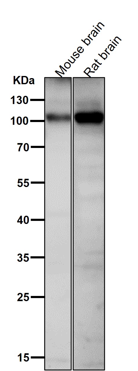 All lanes use the Antibody at 1:1K dilution for 1 hour at room temperature