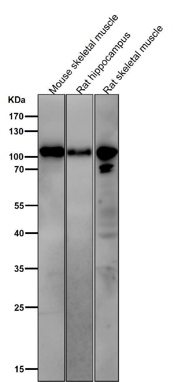 All lanes use the Antibody at 1:1K dilution for 1 hour at room temperature