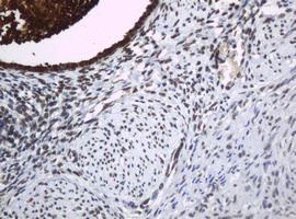 Immunohistochemical staining of paraffin-embedded Human endometrium tissue within the normal limits using anti-WFDC2 mouse monoclonal antibody