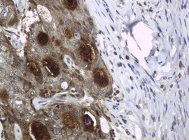 m02685 2 anti he4 wfdc2 mouse monoclonal antibody clone id oti1e12 ihc testing 5