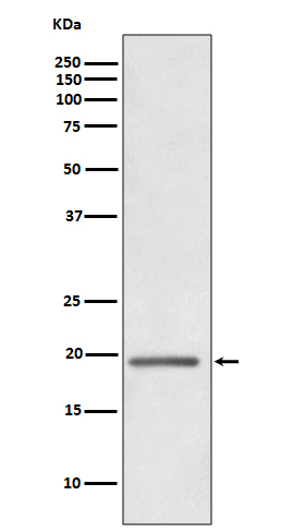 Western blot analysis of HE4 expression in human ovary cancer whole cell lysate