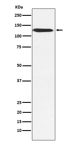 Western blot analysis of SNF2H expression in MCF7 cell lysate