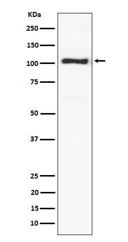 Western blot analysis of ACTN3 expression in mouse skeletal muscle lysate