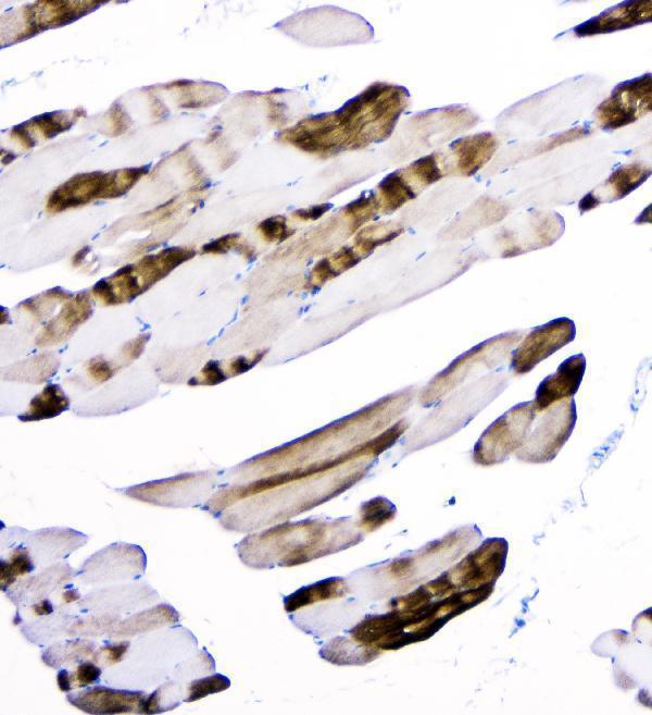m02693 actn3 primary antibodies ihc testing 2