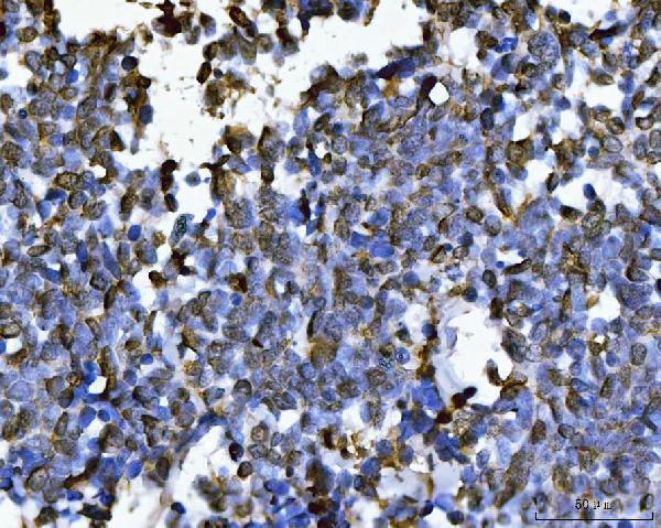 m02698 2 sub1 primary antibodies ihc testing 5