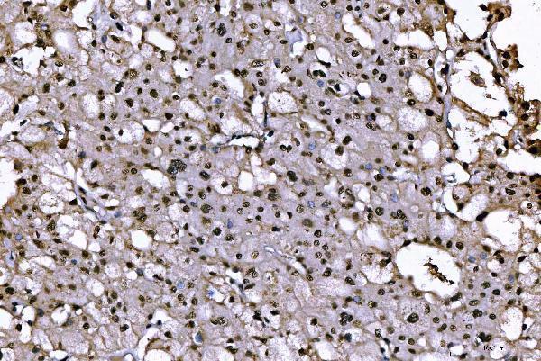 m02698 2 sub1 primary antibodies ihc testing 7