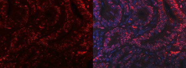 m02698 3 sub1 primary antibodies if testing 13