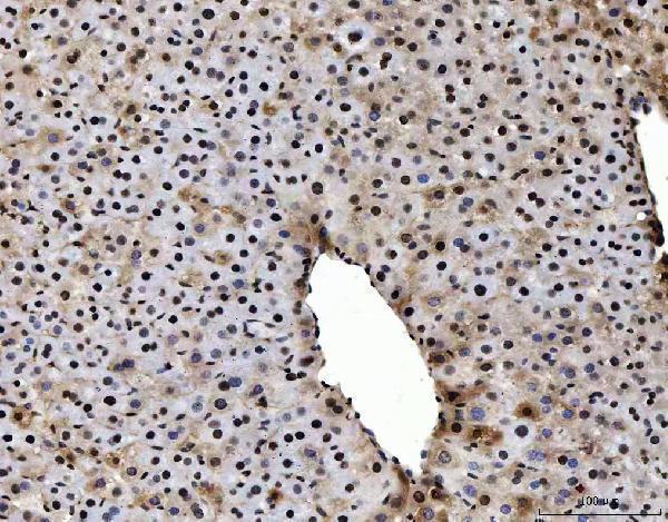 m02698 3 sub1 primary antibodies ihc testing 10