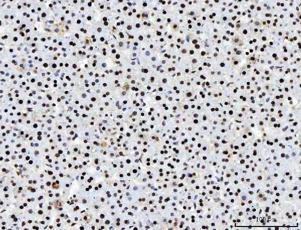 m02698 3 sub1 primary antibodies ihc testing 11