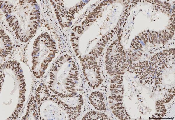 m02698 3 sub1 primary antibodies ihc testing 2