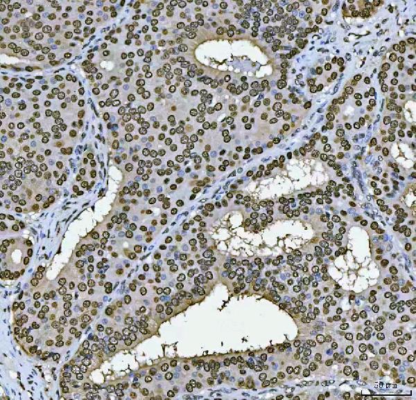 m02698 3 sub1 primary antibodies ihc testing 3
