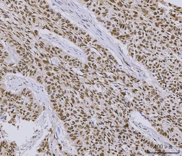 m02698 3 sub1 primary antibodies ihc testing 4