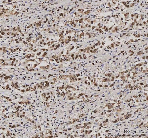 m02698 3 sub1 primary antibodies ihc testing 6