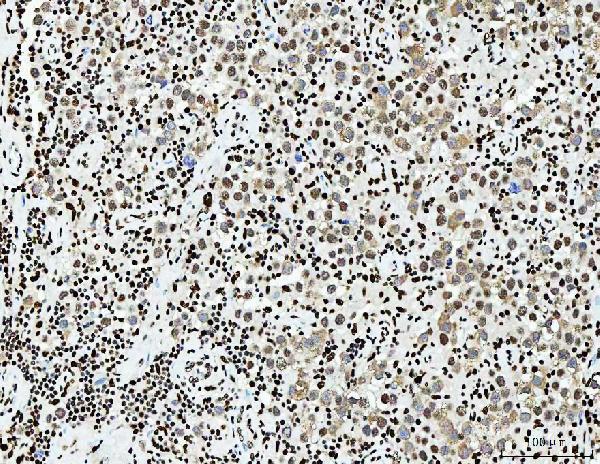 m02698 3 sub1 primary antibodies ihc testing 7