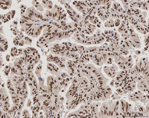 m02698 3 sub1 primary antibodies ihc testing 8