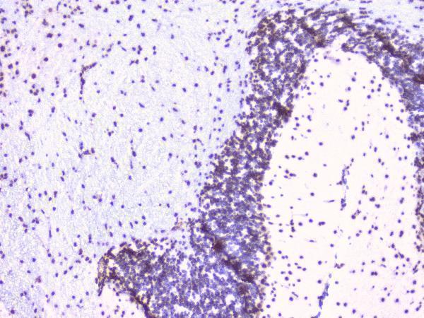 m02702 1 rbap48 primary antibodies ihc testing 7