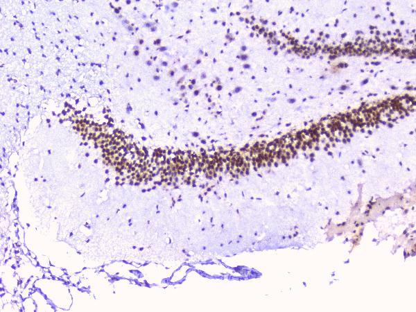 IHC analysis of RbAp48 using anti-RbAp48 antibody (M02702-1). RbAp48 was detected in paraffin-embedded section of rat brain tissues. Heat mediated antigen retrieval was performed in citrate buffer (pH6, epitope retrieval solution) for 20 mins. The tissue section was blocked with 10% goat serum. The tissue section was then incubated with 1μg/ml mouse anti-RbAp48 Antibody (M02702-1) overnight at 4°C. Biotinylated goat anti-mouse IgG was used as secondary antibody and incubated for 30 minutes at 37°C. The tissue section was developed using Strepavidin-Biotin-Complex (SABC)(Catalog # SA1021) with DAB as the chromogen.