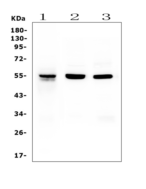 Western blot analysis of RbAp48 using anti-RbAp48 antibody (M02702-1). Electrophoresis was performed on a 5-20% SDS-PAGE gel at 70V (Stacking gel) / 90V (Resolving gel) for 2-3 hours. The sample well of each lane was loaded with 50ug of sample under reducing conditions. Lane 1: human Jurkat whole cell lysates Lane 2: rat thymus tissue lysates Lane 3: mouse spleen tissue lysates After Electrophoresis, proteins were transferred to a Nitrocellulose membrane at 150mA for 50-90 minutes. Blocked the membrane with 5% Non-fat Milk/ TBS for 1.5 hour at RT. The membrane was incubated with mouse anti-RbAp48 antigen affinity purified monoclonal antibody (Catalog # M02702-1) at 0.5 μg/mL overnight at 4°C, then washed with TBS-0.1%Tween 3 times with 5 minutes each and probed with a goat anti-mouse IgG-HRP secondary antibody at a dilution of 1:10000 for 1.5 hour at RT. The signal is developed using an Enhanced Chemiluminescent detection (ECL) kit (Catalog # EK1001) with Tanon 5200 system. A specific band was detected for RbAp48 at approximately 55KD. The expected band size for RbAp48 is at 48KD.