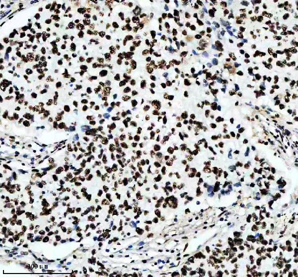 m02702 rbbp4 primary antibodies ihc testing 1