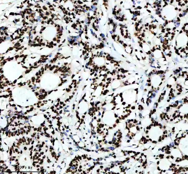 m02702 rbbp4 primary antibodies ihc testing 10