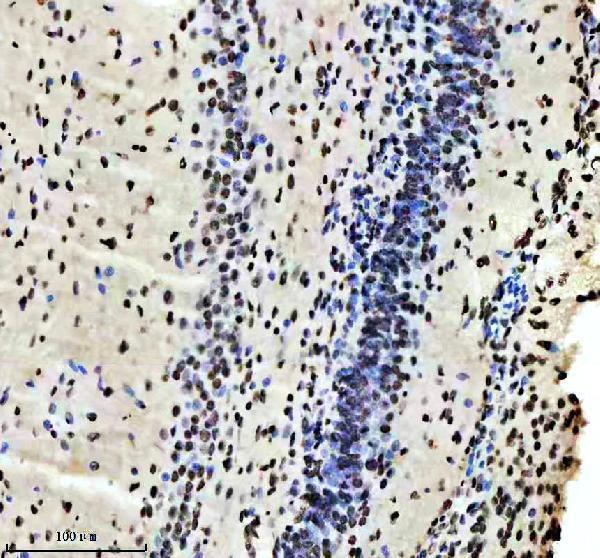 m02702 rbbp4 primary antibodies ihc testing 11