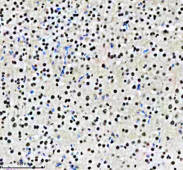 m02702 rbbp4 primary antibodies ihc testing 12