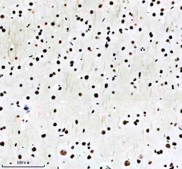 m02702 rbbp4 primary antibodies ihc testing 13