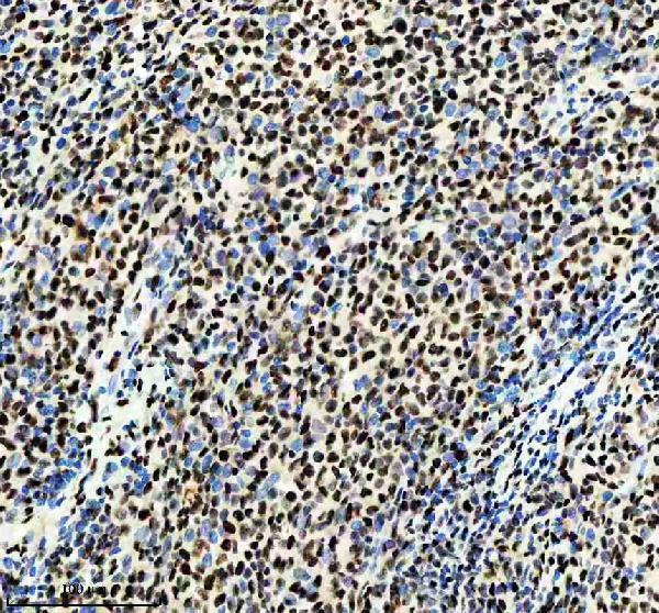 m02702 rbbp4 primary antibodies ihc testing 2