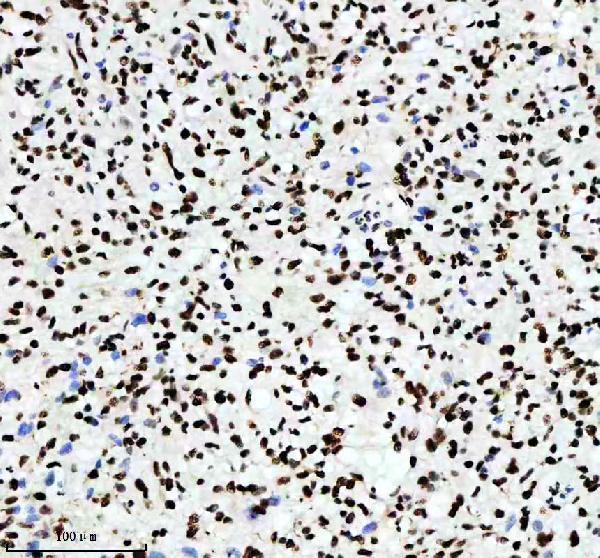 m02702 rbbp4 primary antibodies ihc testing 3