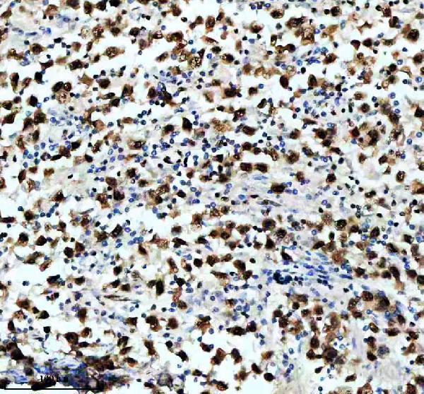 m02702 rbbp4 primary antibodies ihc testing 4