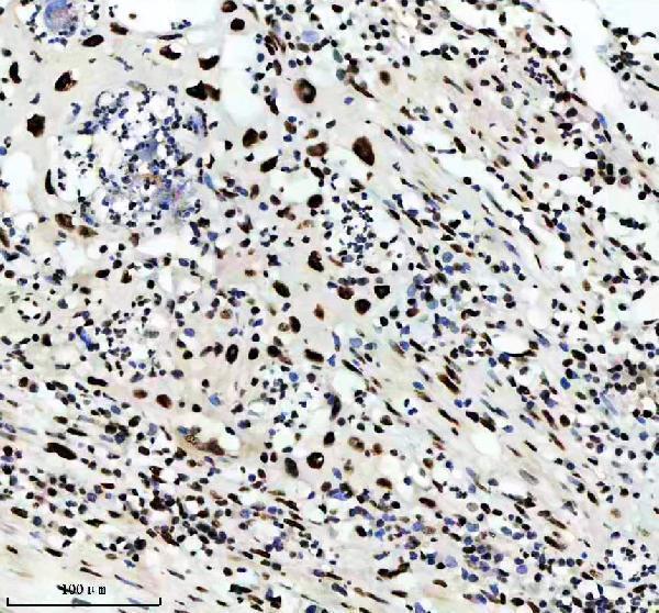 m02702 rbbp4 primary antibodies ihc testing 5