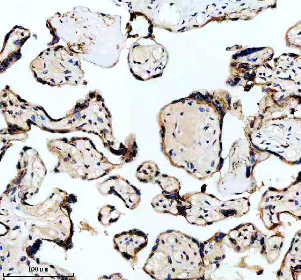 m02702 rbbp4 primary antibodies ihc testing 6