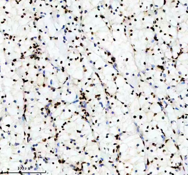 m02702 rbbp4 primary antibodies ihc testing 7