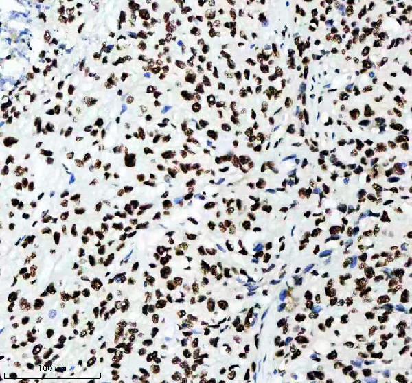 m02702 rbbp4 primary antibodies ihc testing 8
