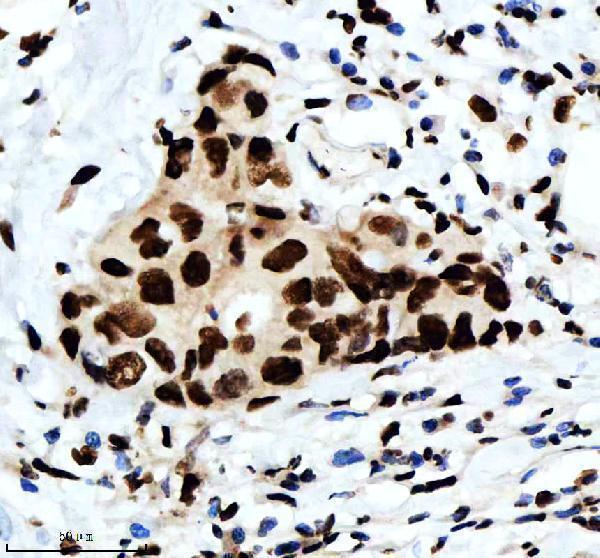 m02702 rbbp4 primary antibodies ihc testing 9