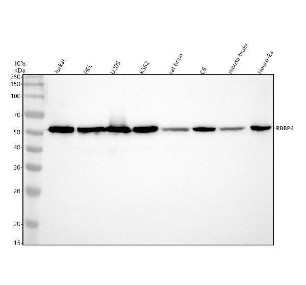 m02702 rbbp4 primary antibodies wb testing 1
