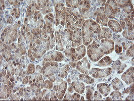 m02706 1 anti jnk2 mapk9 mouse monoclonal antibody clone id oti1a1 ihc testing 4