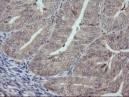 m02706 1 anti jnk2 mapk9 mouse monoclonal antibody clone id oti1a1 ihc testing 6