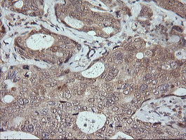 m02706 1 anti jnk2 mapk9 mouse monoclonal antibody clone id oti1a1 ihc testing 7