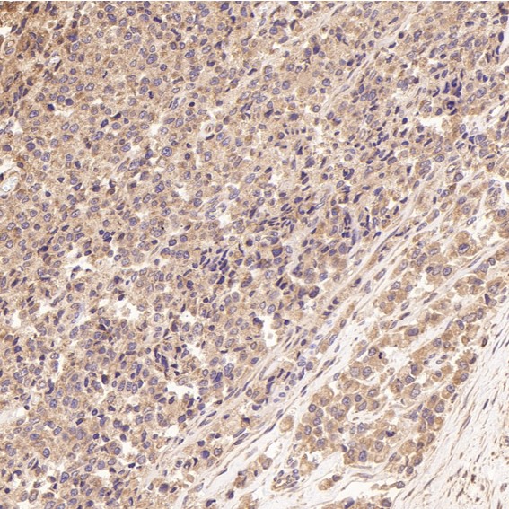 m02706 ihc8