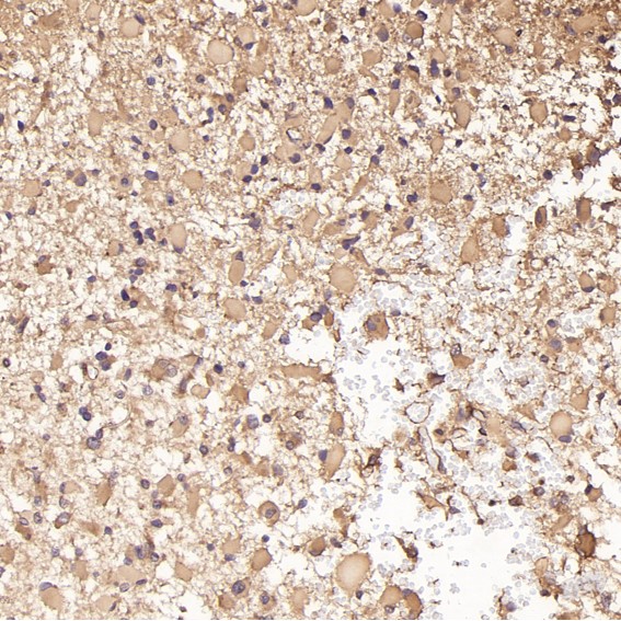 m02706 ihc9