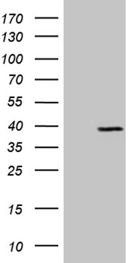 Western blot analysis of extracts (35ug) from mouse brain tissue lysate by using anti-PRRT2 monoclonal antibody (1:500).