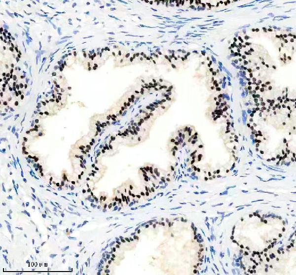IHC analysis of NKX3-1 using anti-NKX3-1 antibody (M02709)