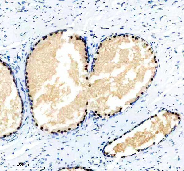 IHC analysis of NKX3-1 using anti-NKX3-1 antibody (M02709)