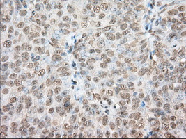m02714 1 anti pde4a mouse monoclonal antibody clone id oti1c8 ihc testing 2